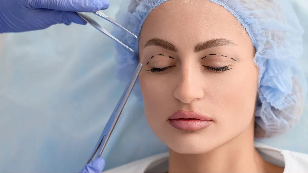 Cắt mí rồi có cắt lại được không? Nguyên nhân và lưu ý cần biết