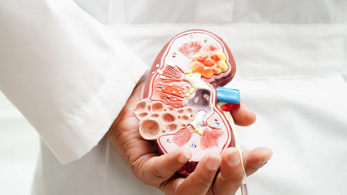Biến chứng thận do bệnh lupus ban đỏ hệ thống nguy hiểm thế nào?