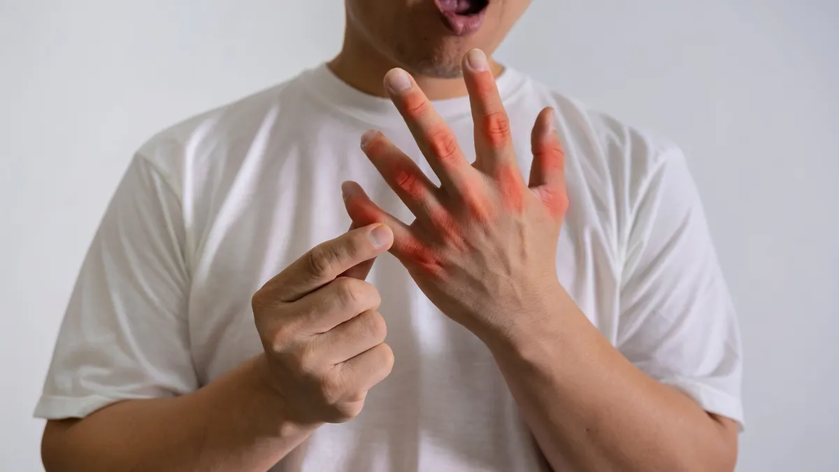 5 đồ uống hỗ trợ kiểm soát axit uric, phòng gout tái phát