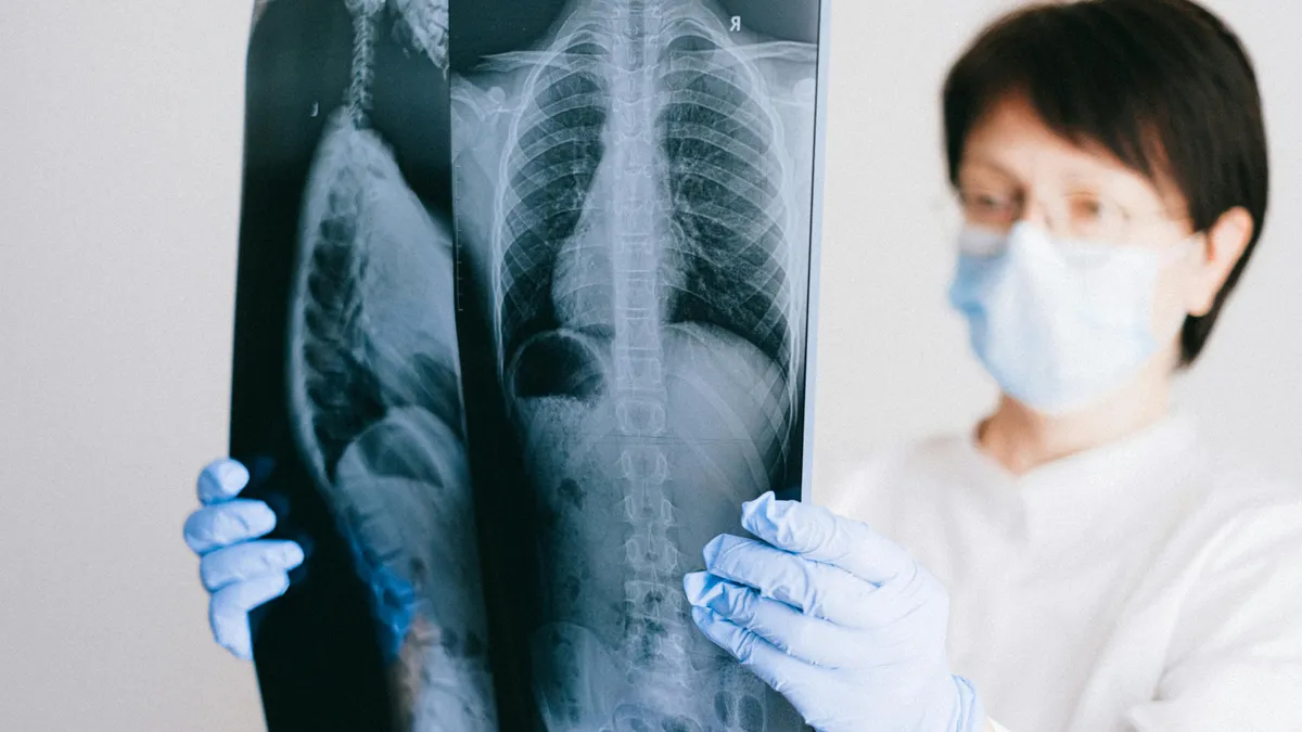 Nguyên nhân gây ung thư phổi và các yếu tố nguy cơ không ngờ tới