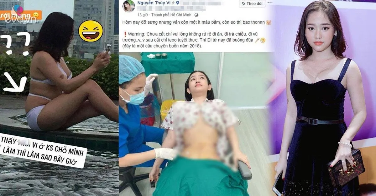 "Hotgirl Cà Mau" Thúy Vi bạo tay chi 170 triệu để hút 2kg mỡ bụng rồi... bơm vào mông