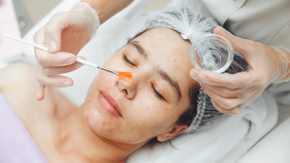 Có nên peel Glycolic Acid không? Lợi ích và cách dùng an toàn