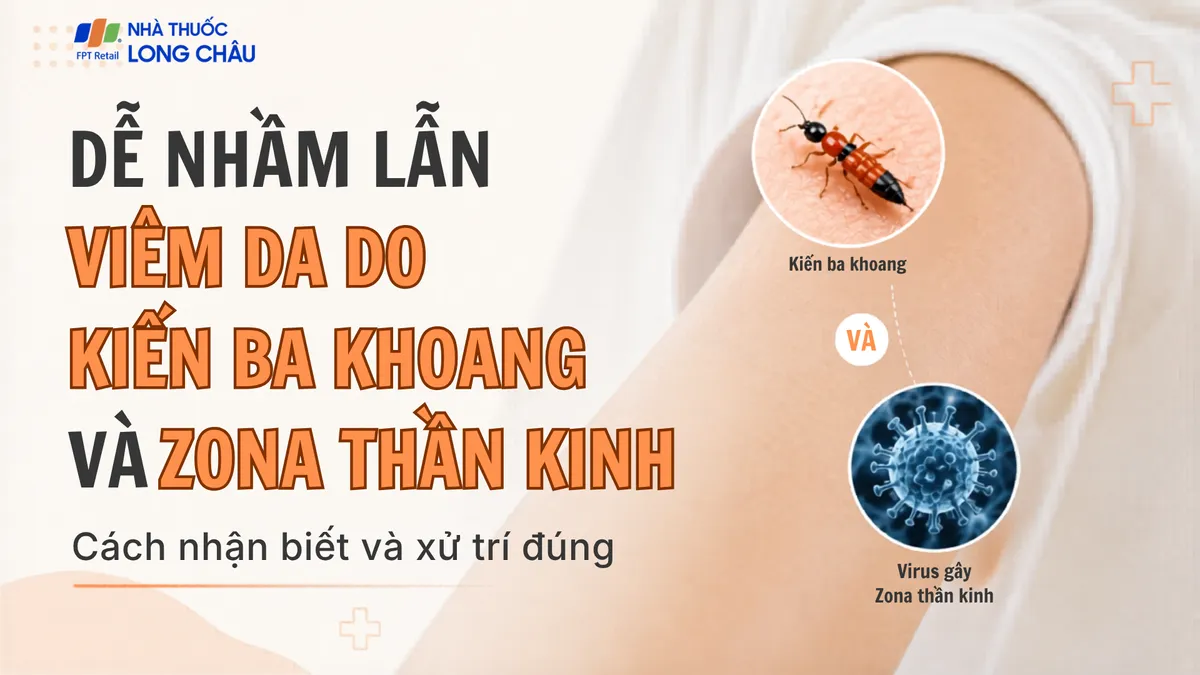 Viêm da do kiến ba khoang dễ nhầm với Zona: Cách nhận biết và xử trí đúng
