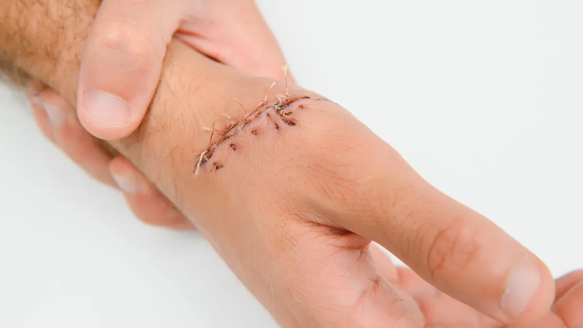 Nhiễm trùng vết mổ là gì? Nguyên nhân, triệu chứng và cách trị