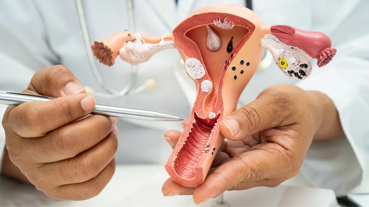 Viêm lộ tuyến tử cung 1cm là nặng hay nhẹ? Có cần điều trị không?