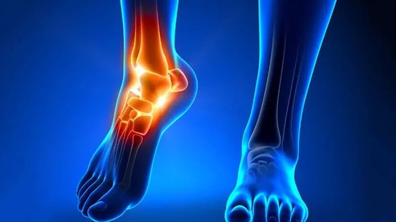 Hội chứng xương thuyền phụ là gì? Có chữa được không?
