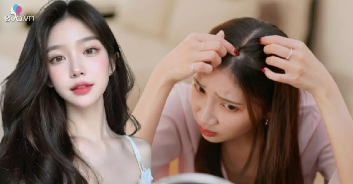 Tóc rụng liên tục, ngày càng mỏng, chuyên gia bật mí 10 thói quen “cứu nguy” giúp tóc con mọc lên tua tủa