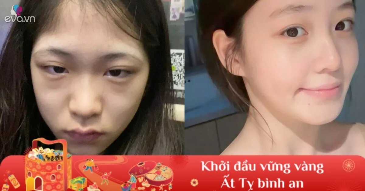 5 bước "cấp cứu" khẩn cấp làn da sau những đêm thức khuya ngày Tết