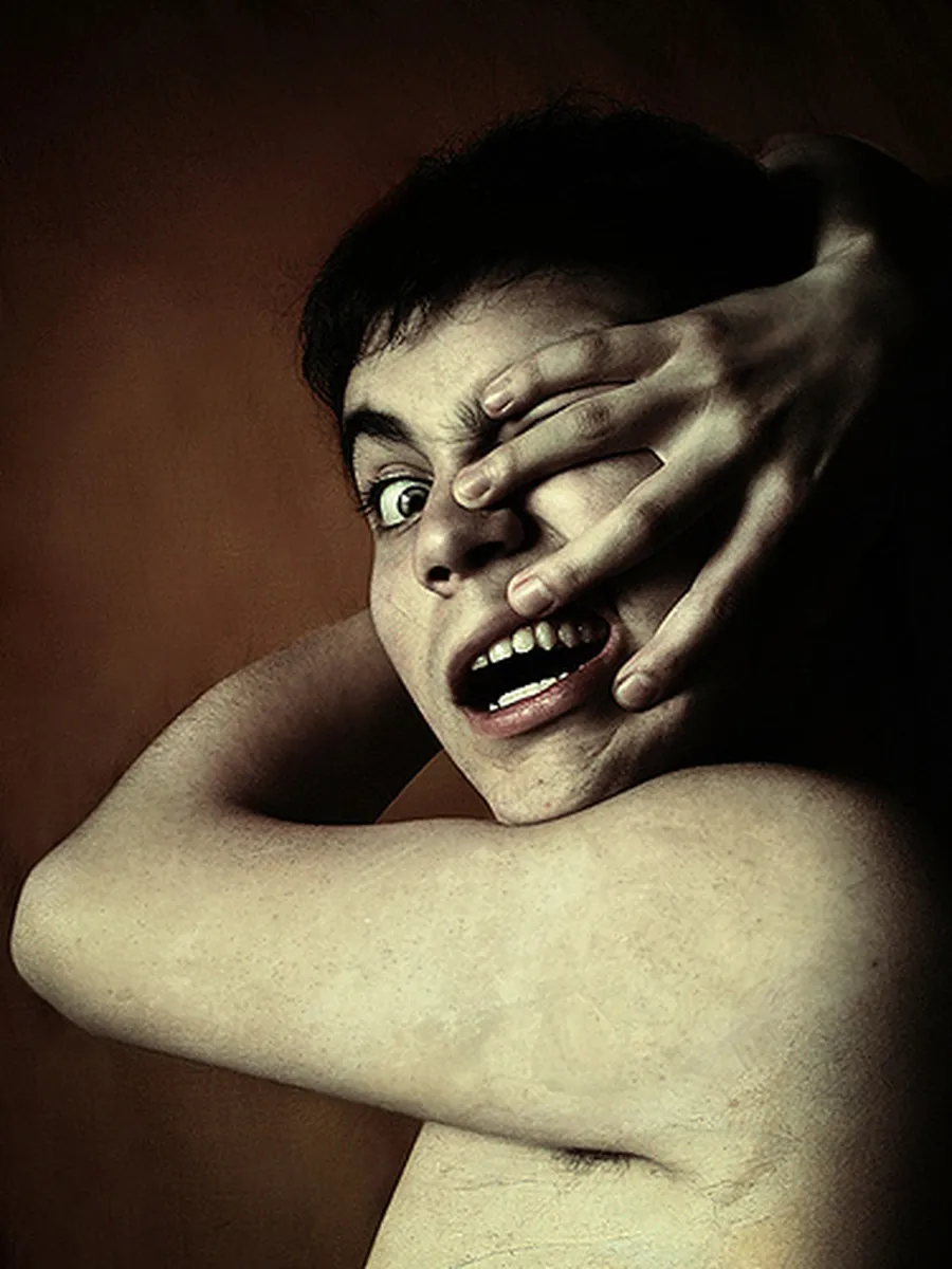 Kì lạ hội chứng "bàn tay ngoài hành tinh"