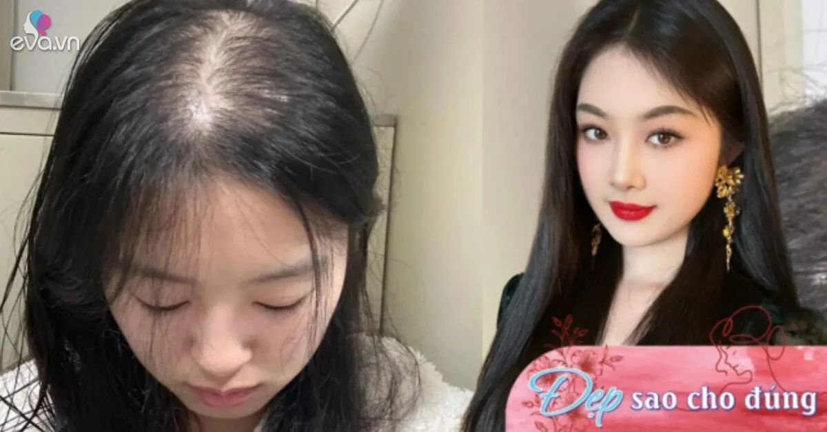 Tóc mọc chậm mãi không dài lại hay rụng nhiều, thử ngay bí quyết giúp tóc dài gấp đôi trong 1 tháng của gái Hàn