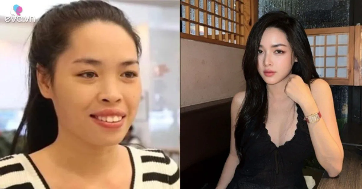 Nhan sắc hiện tại của hot girl từng "lột xác" nhờ phẫu thuật thẩm mỹ