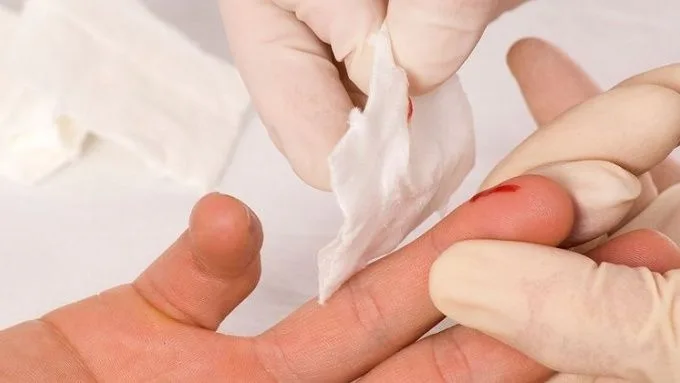Phơi nhiễm là gì? Cách xử lý và chữa trị phơi nhiễm ra sao?
