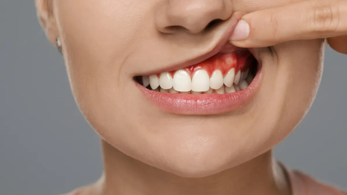 Răng bọc sứ bị chảy máu có nguy hiểm không? Nguyên nhân và cách xử lý