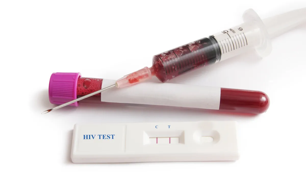 Test nhanh HIV sau bao lâu thì chính xác và cần lưu ý gì?