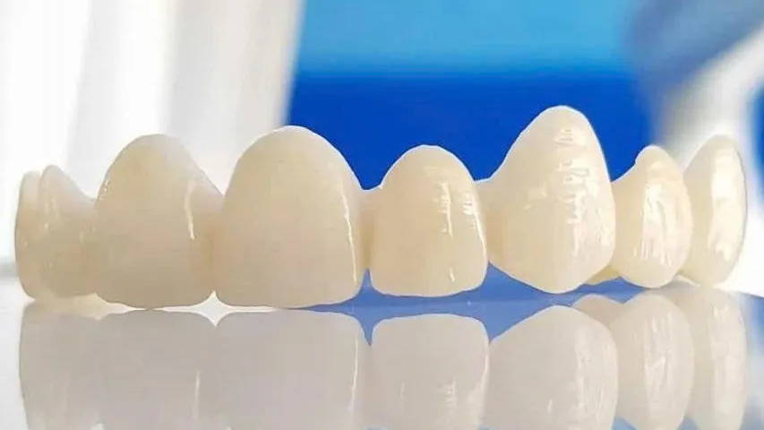 Răng sứ khi về già có đảm bảo độ bền và an toàn hay không?