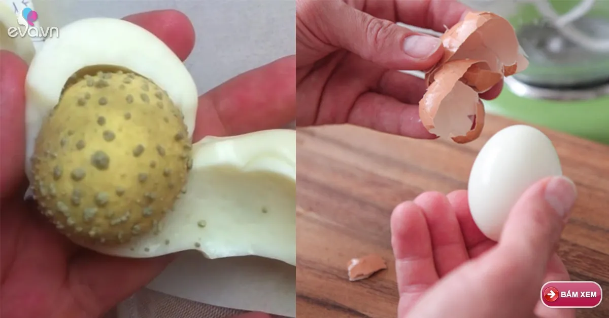 Mụn đầu đen đến mấy cũng sẽ chào thua bằng cách dùng trứng gà luộc