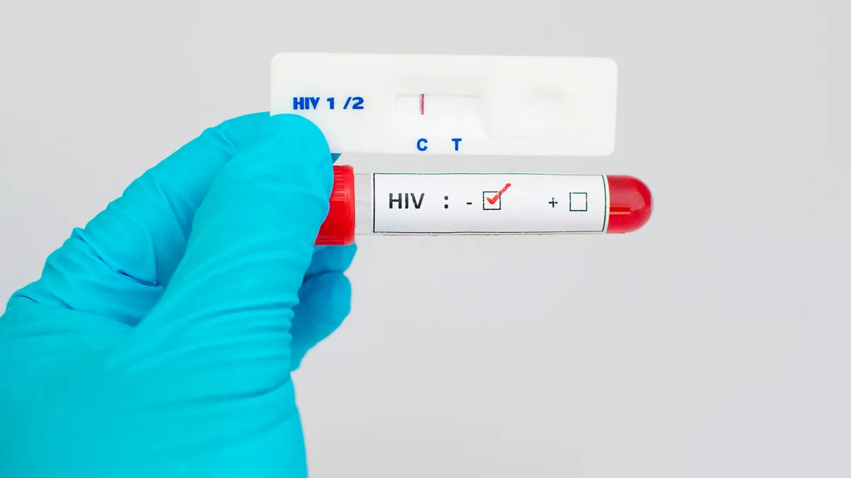 Xét nghiệm HIV 3 tháng âm tính đã an toàn chưa? Khi nào cần xét nghiệm lại?