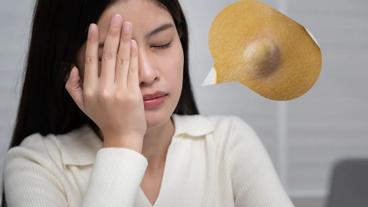 U bã đậu ở mí mắt có nguy hiểm không? Nguyên nhân và cách điều trị