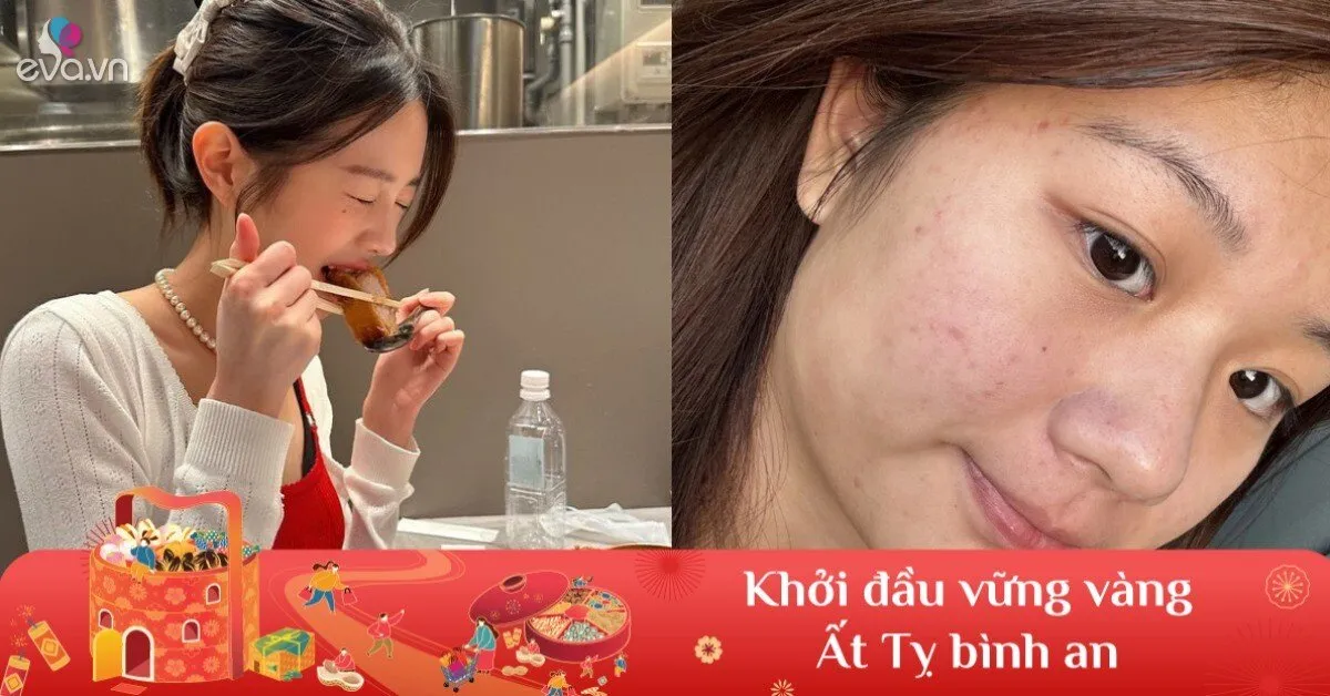 3 thực phẩm vào ngày Tết càng dễ khiến lão hóa sớm, chị em lưu ý để không mất vẻ ngoài rạng rỡ đầu năm