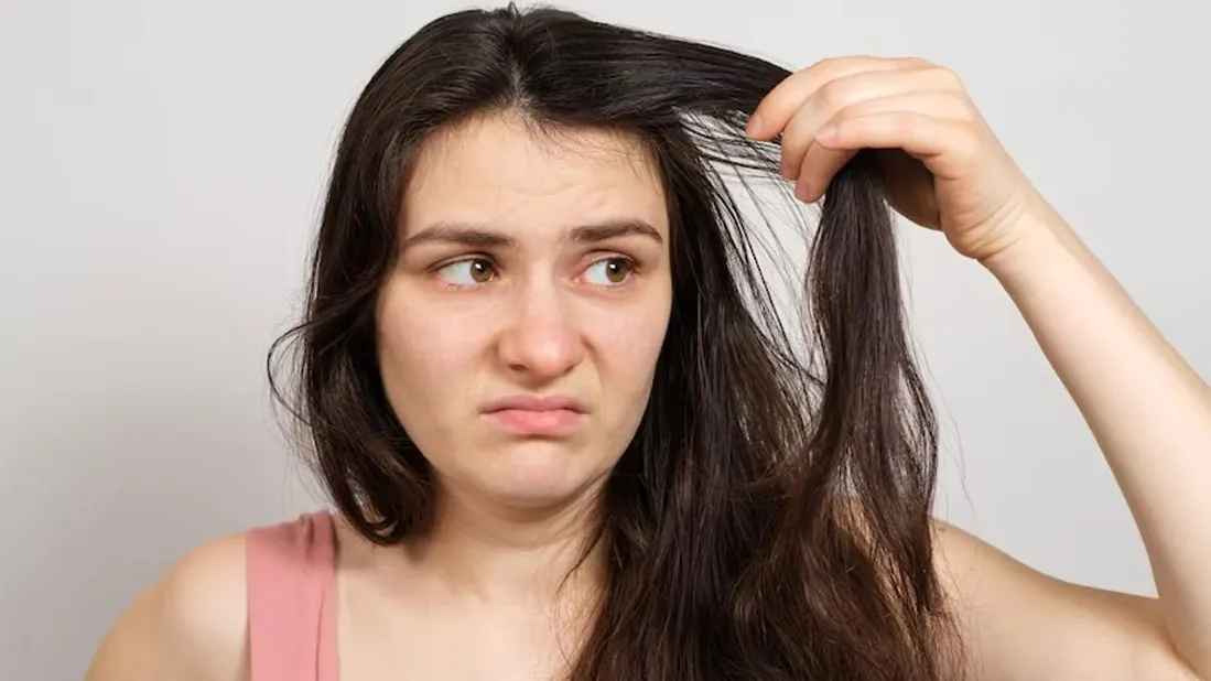Cách trị đổ mồ hôi đầu ở người lớn​: Giải pháp đơn giản nhưng hiệu quả