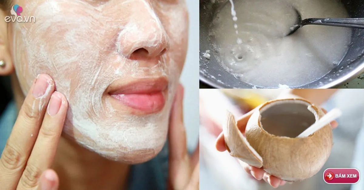 Gột sạch mụn cùng vết thâm nhờ nước dừa pha cùng mật ong