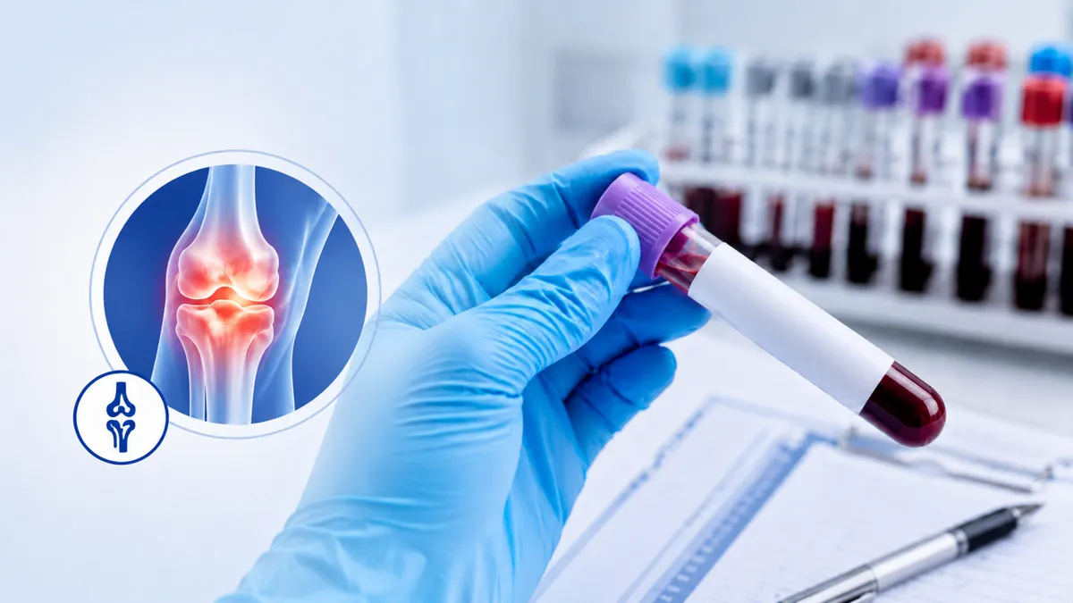 Xét nghiệm viêm khớp ở đâu uy tín? Những tiêu chí lựa chọn nơi xét nghiệm