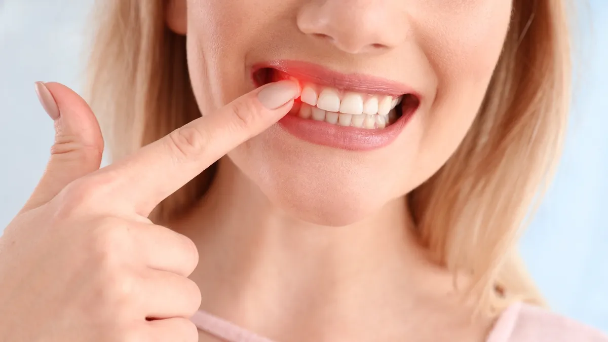Chảy máu chân răng: Nguyên nhân và cách khắc phục hiệu quả