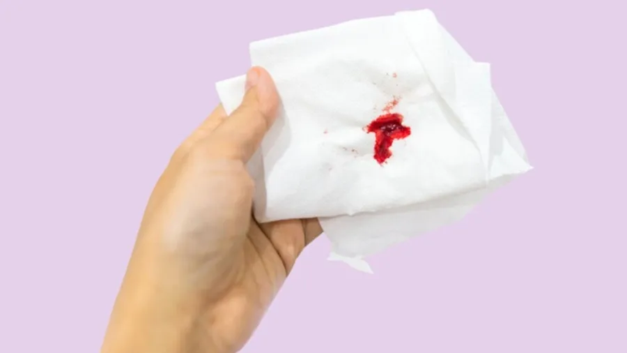 Quan hệ ra máu đỏ tươi ở nam giới khi nào cần đi khám?