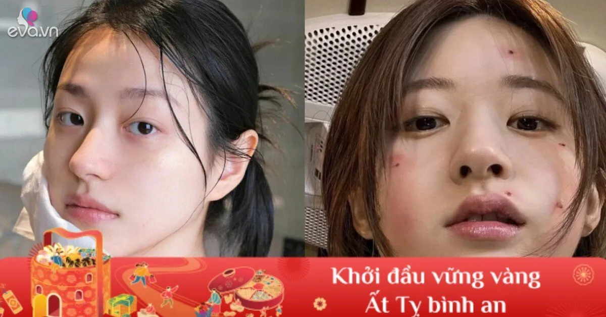 Còn 14 ngày nữa tới Tết, chị em cần bỏ ngay bước chăm da này nếu không muốn làn da "xuống dốc không phanh"