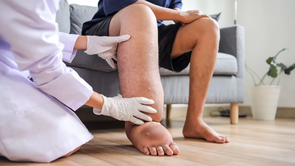 Thuốc điều trị giun chỉ bạch huyết: Thông tin cần biết để bảo vệ sức khỏe