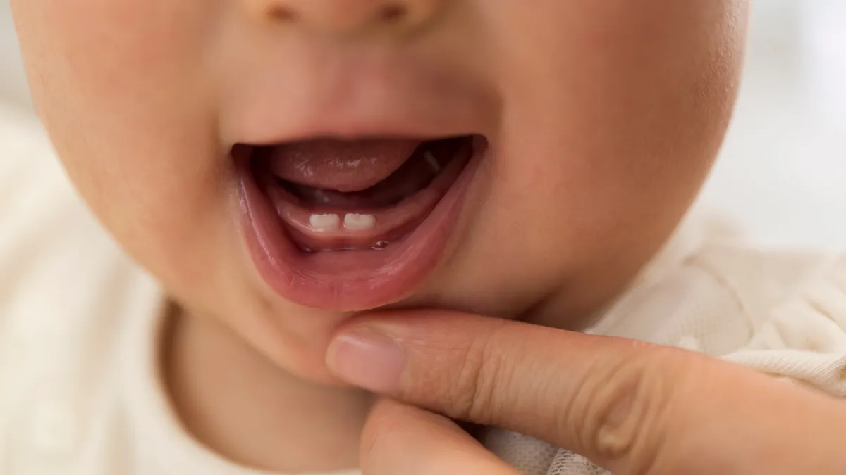 Trẻ mọc răng nanh trước răng cửa có sao không? Nguyên nhân và cách chăm sóc trẻ