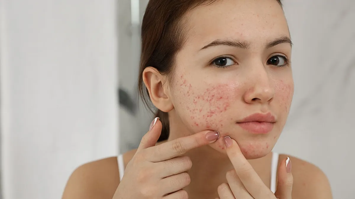 Các dấu hiệu dậy thì ở nữ và những thay đổi của cơ thể