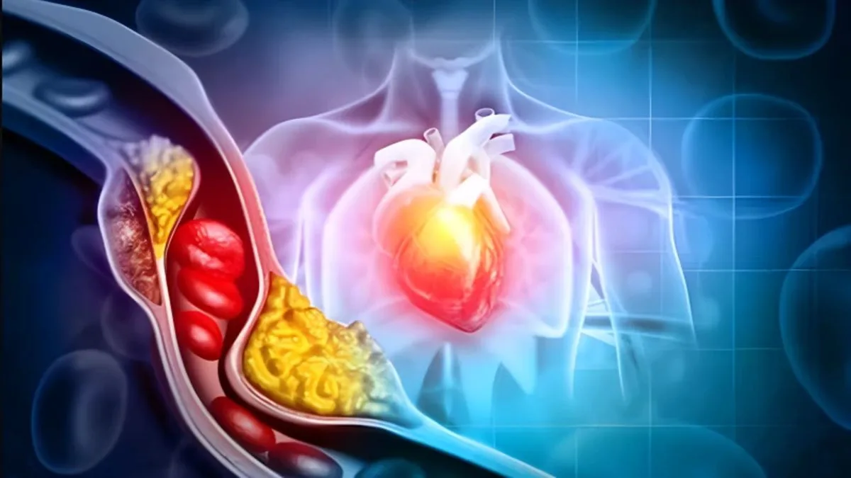Cholesterol là gì? Biện pháp kiểm soát cholesterol trong máu