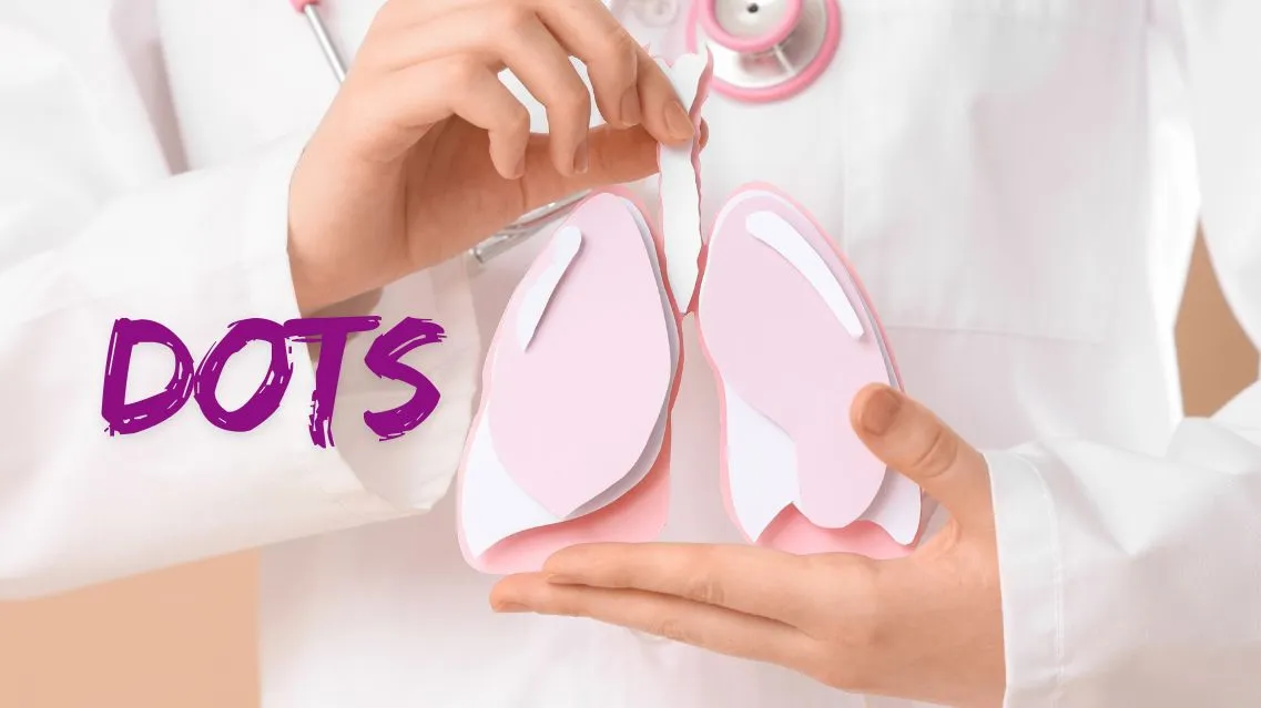 DOTS là gì? Vai trò của chiến lược DOTS trong kiểm soát và điều trị bệnh lao