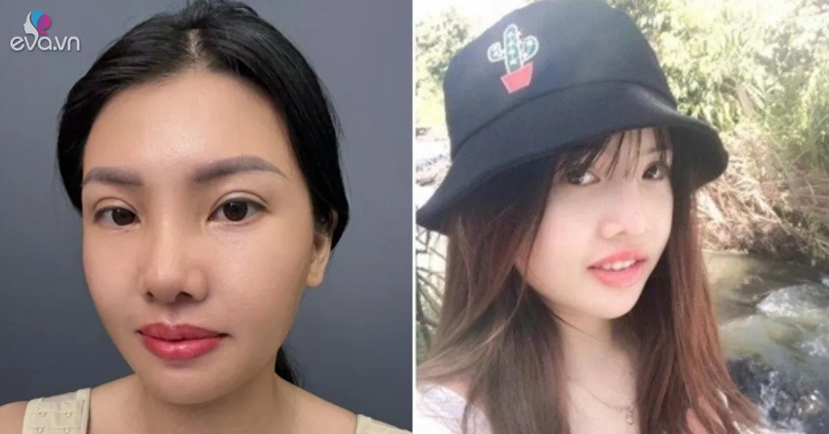 Sau 8 năm "dao kéo", diện mạo của "Thị Nở tái sinh" Quách Phượng gây bão