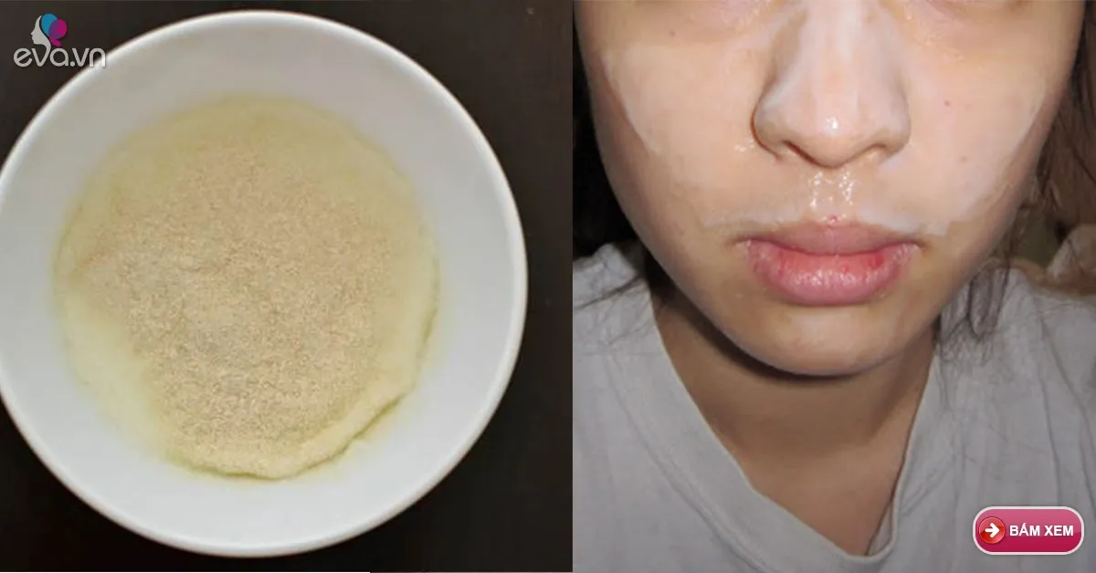Mụn đầu đen cứng đầu đến mấy cũng phải trồi lên nhờ thứ này