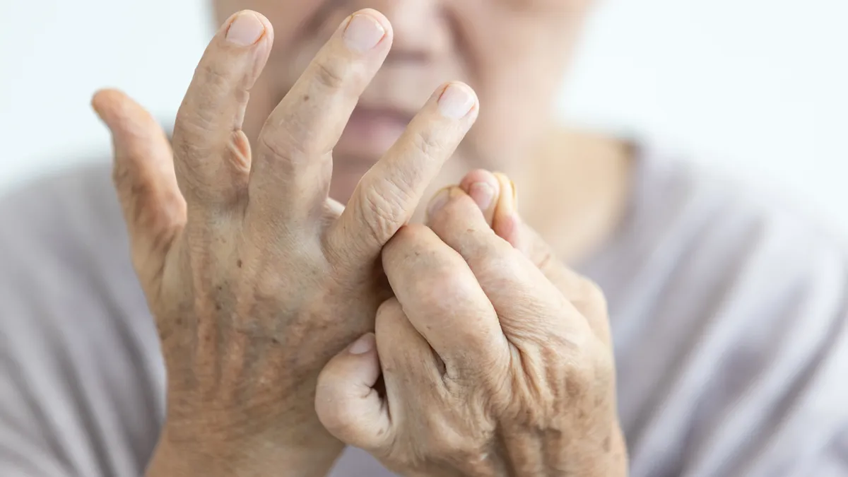 Sự khác nhau giữa viêm khớp dạng thấp và Lupus mà bạn nên biết