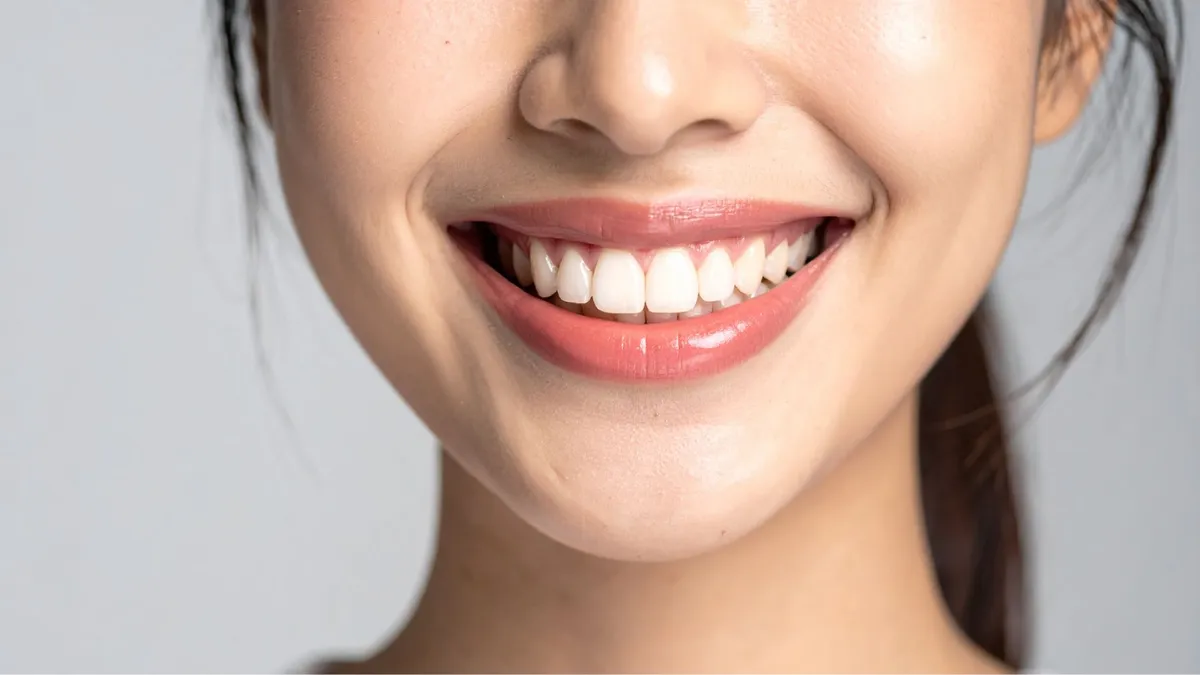 Cấy mỡ rãnh cười là gì? Ưu và nhược điểm của phương pháp
