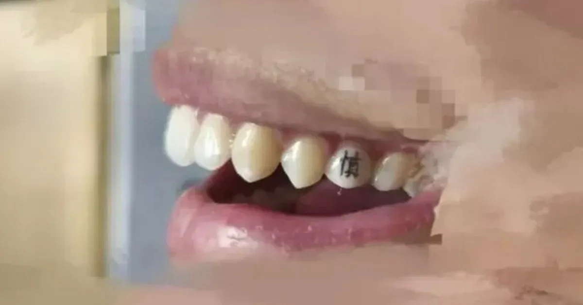Chán hình xăm trên da, giới trẻ Trung Quốc chuyển sang xăm răng