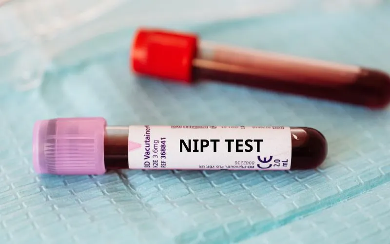 Xét nghiệm NIPT 4: Phát hiện sớm bất thường nhiễm sắc thể thai nhi