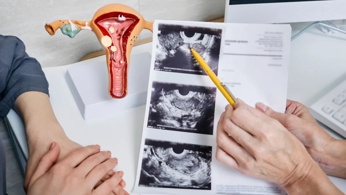 Đa nhân xơ tử cung loại 4 có chữa được không?