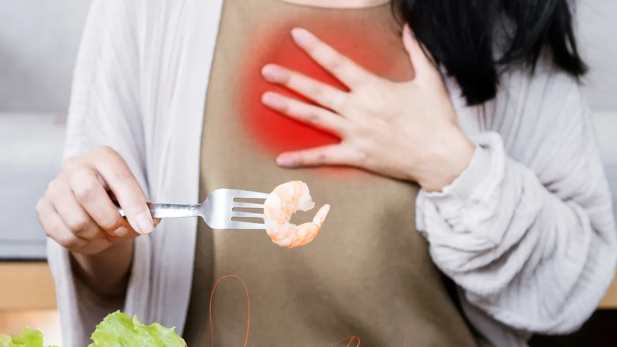 Dị ứng hải sản nên làm gì để xử lý nhanh và an toàn?