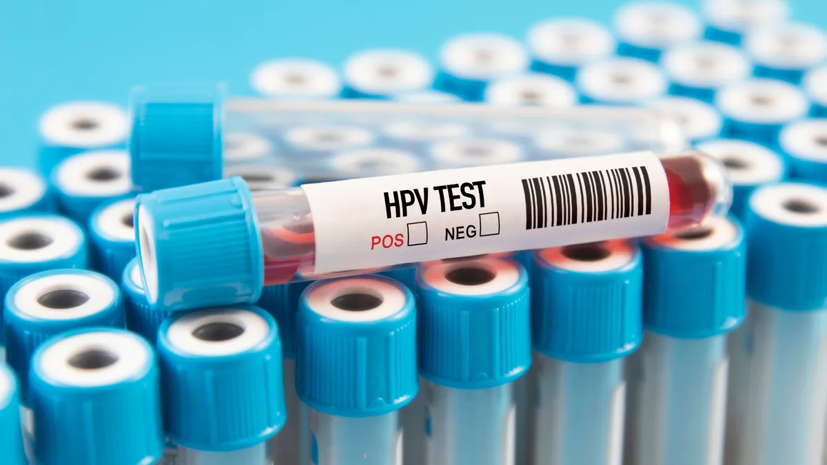 Xét nghiệm HPV là gì? Quy trình, chi phí và cách đọc kết quả
