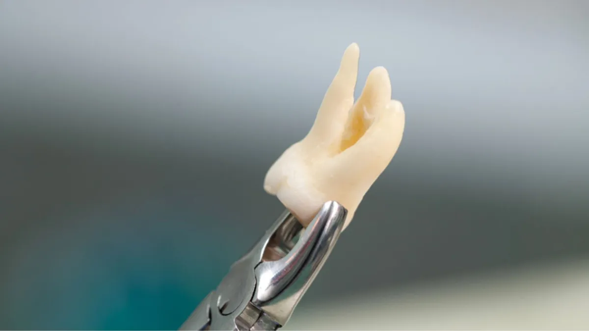 Mỗi người mọc mấy răng khôn? Có nên nhổ răng khôn không?