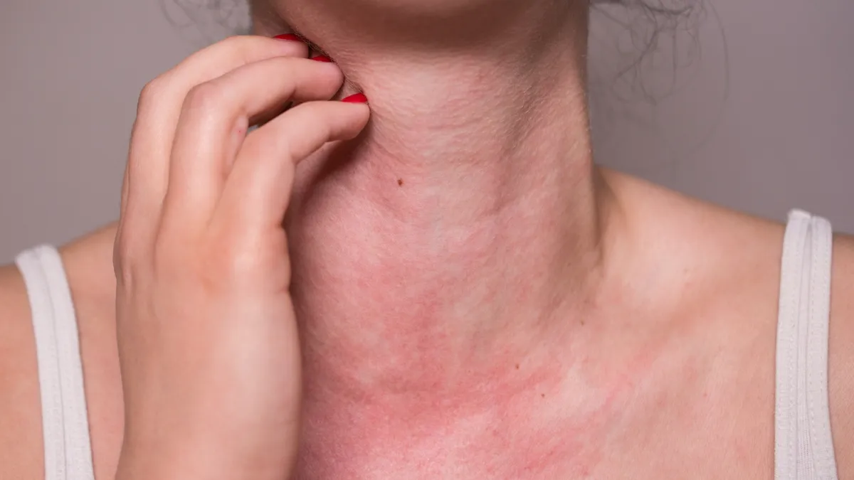 Ngứa da cổ là bệnh gì? Nguyên nhân và cách điều trị hiệu quả