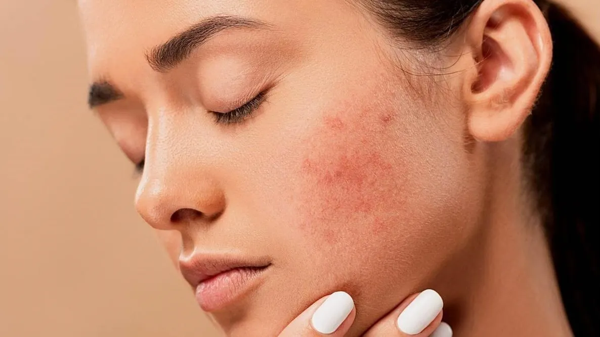 Hướng dẫn cách phục hồi da sau khi dùng rượu thuốc tại nhà