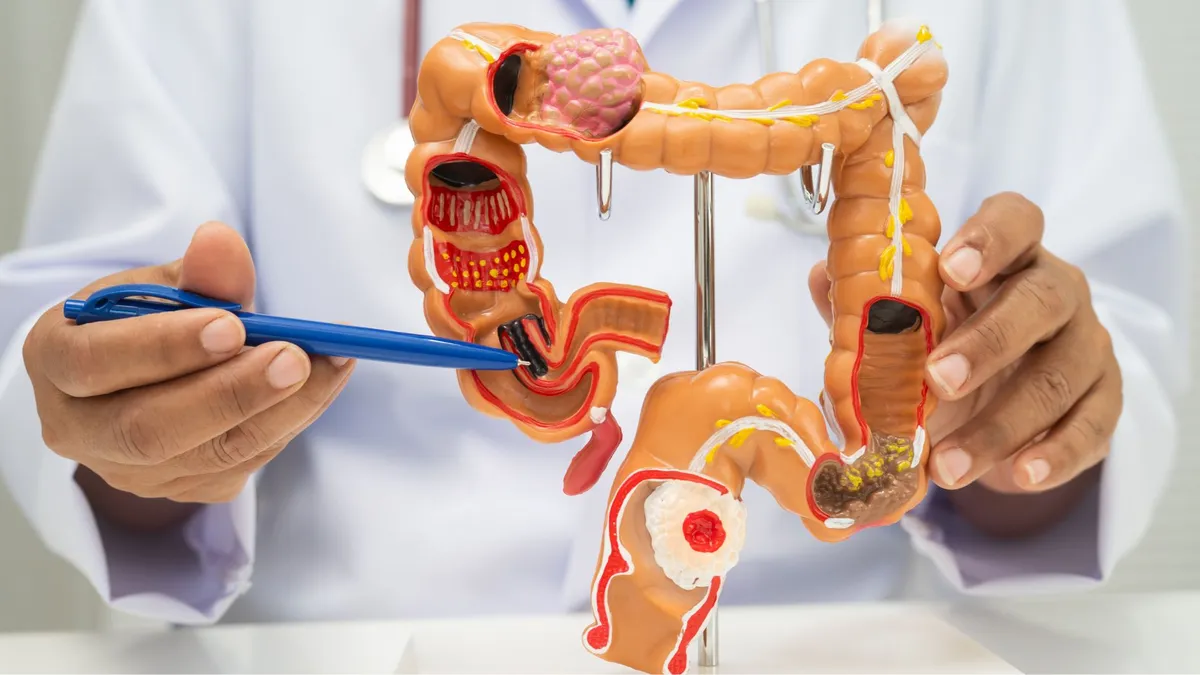 Ai nên thực hiện tầm soát ung thư đường tiêu hóa? Lưu ý khi thực hiện