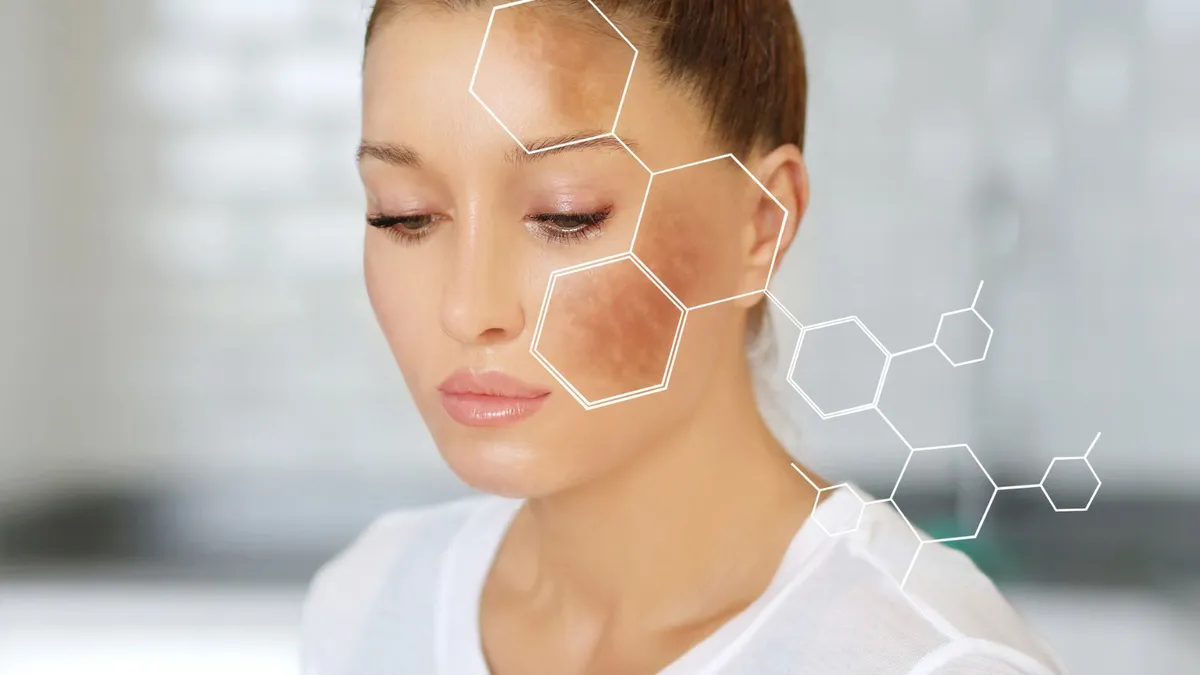 Đốm đen trên da có nguy hiểm không? Nguyên nhân và dấu hiệu cần lưu ý