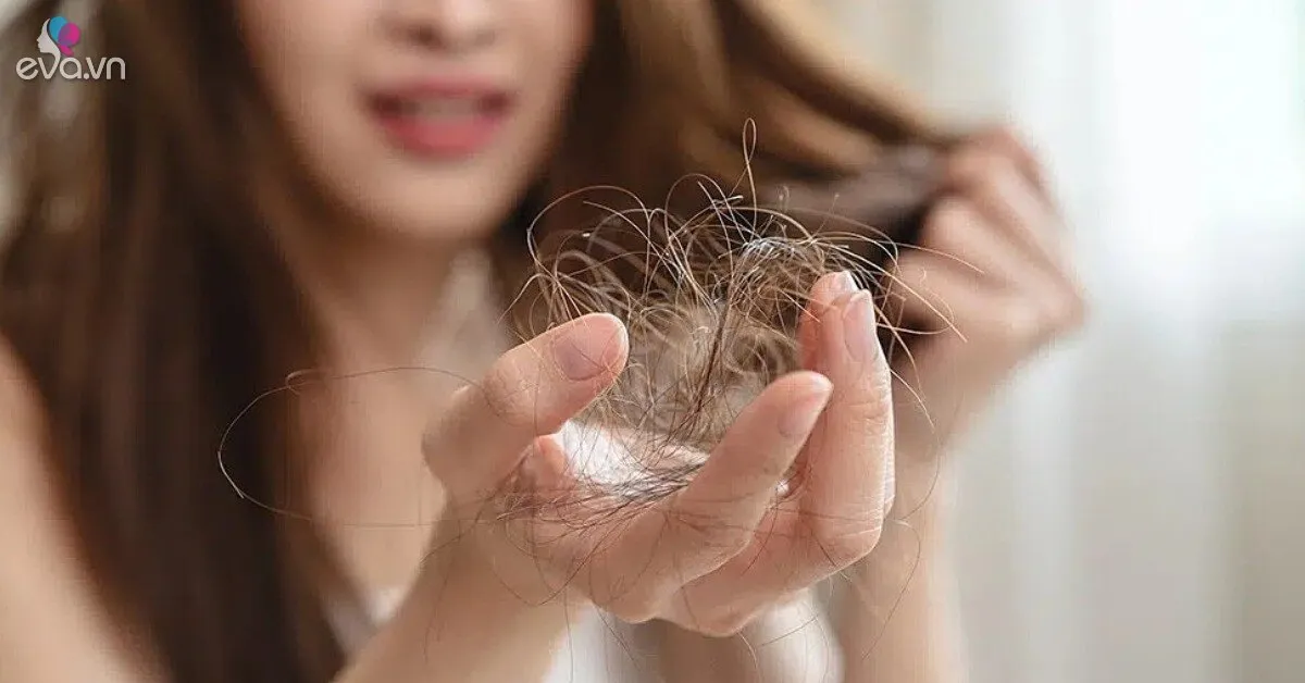 4 nguyên nhân phổ biến khiến vuốt nhẹ tóc cũng rụng cả nắm