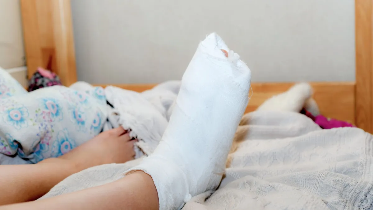 Bó bột chân và những lưu ý quan trọng trong điều trị gãy xương